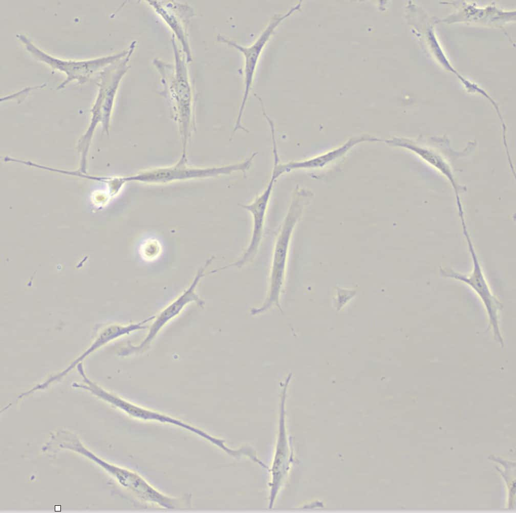 Recombinant Human IL-4 Protein 204-IL-010: R&D Systems