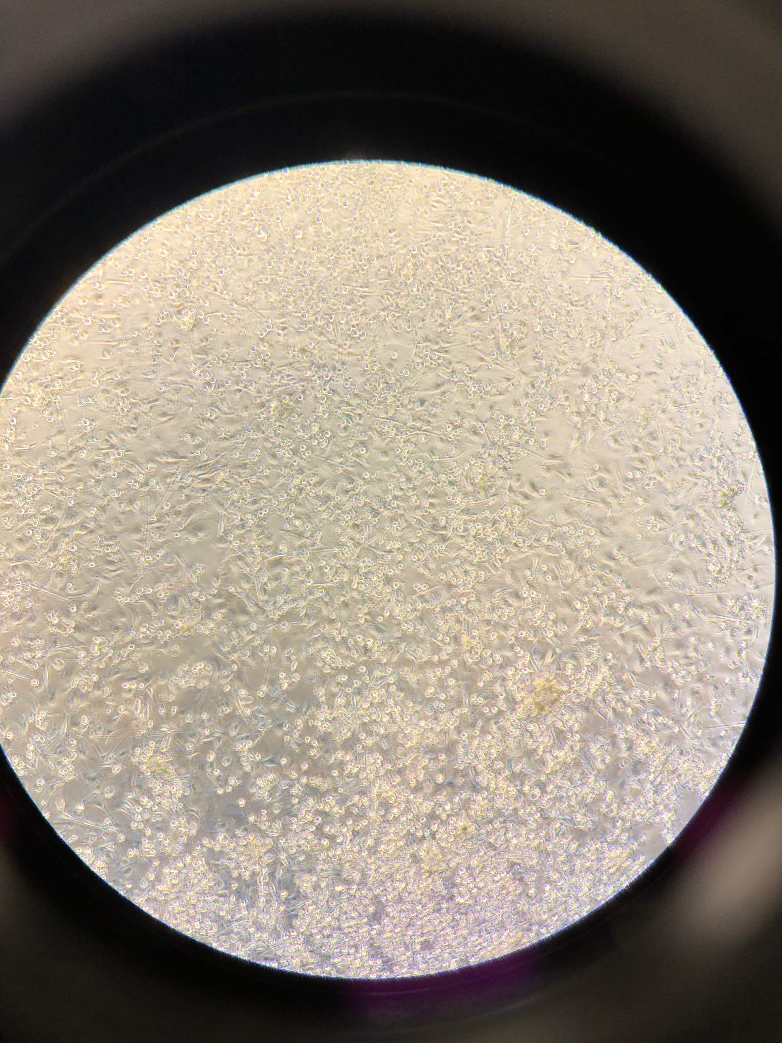 Recombinant Human IL-4 Protein 204-IL-010: R&D Systems