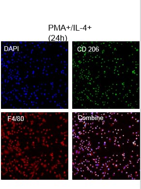 Recombinant Mouse IL-4 Protein, CF (404-ML/CF): Novus Biologicals