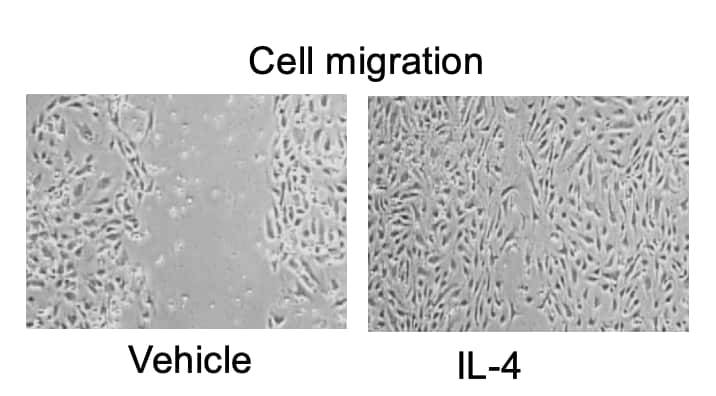 Recombinant Mouse IL-4 Protein, CF (404-ML/CF): Novus Biologicals