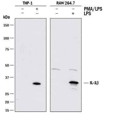 The ubiquitylation of IL-1β limits its cleavage by caspase-1 and targets it  for proteasomal degradation