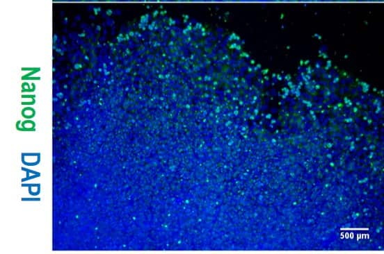 Generation of HEXA-deficient hiPSCs from fibroblasts of a Tay