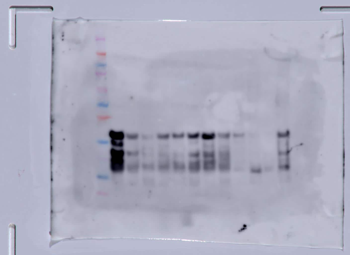 Tgf Beta 1 2 3 Antibody Mab15 R D Systems